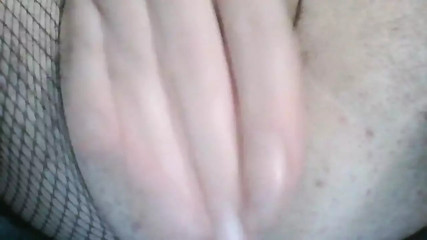 Dilatation Anal