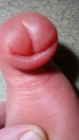 Jens11 hard pumped cock and foreskin