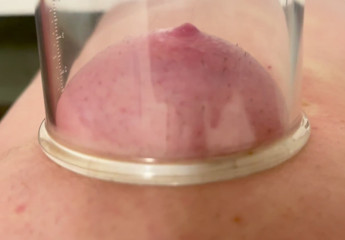 Nipple sucker thumbnail