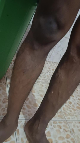 Hairy Ass