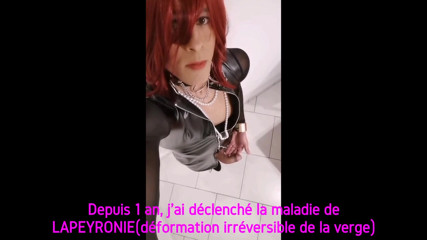 LAPEYRONIE's disease
