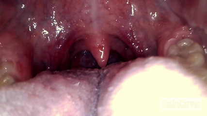 /beam/69635c7a3f0d81077a4946e6