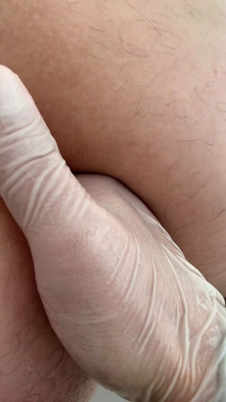 Anal fisting