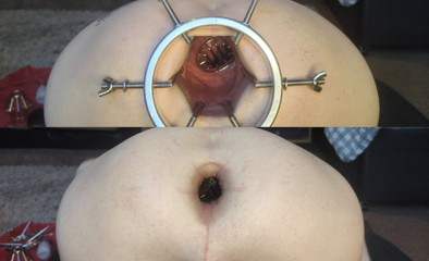 Both holes stretched ft David Anderson thumbnail