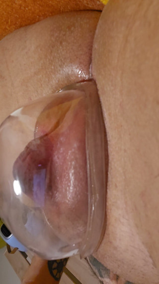 Pumping my cuntboy FTM pussy until it's fat and shiny