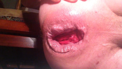 anal insertion prolapse ass gaping huge asshole