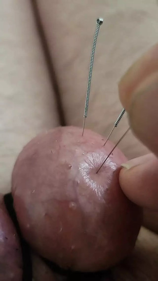 Needles in my balls