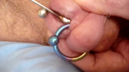 12 mm insertion close up