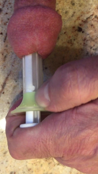Sounding with a 14.65 mm syringe