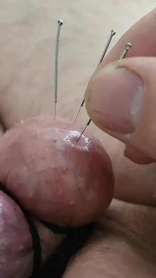 Needles in an egg