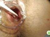 Gyno exam with speculum close up in hairy pussy