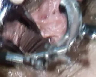 /beam/67a86261cc498f247e876769