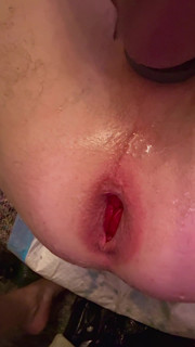 Anal Punching with My Girlfriend