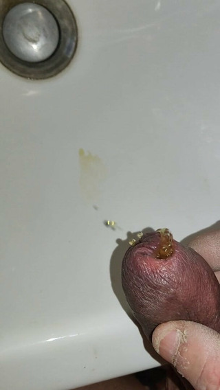 Piss