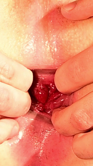 Cuckold Anal Training x extrem closeup