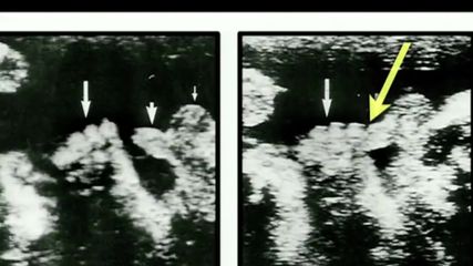 /beam/67a85f64cc498f247e5b36bc