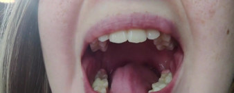 Throat Fetish