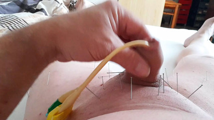Needles and catheters