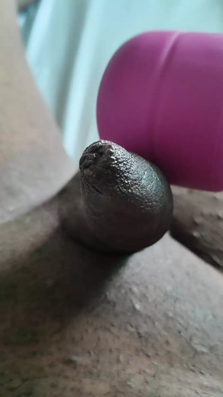 Small cock under foreskin