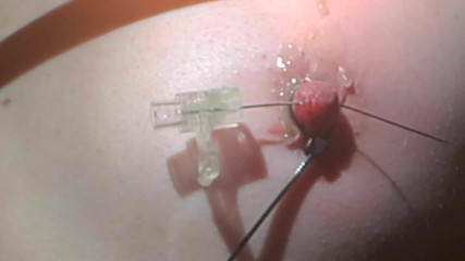 Niples torture extreme 2