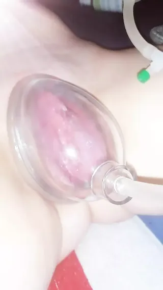 /beam/67a8622acc498f247e84c8d7