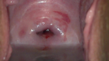 cervix