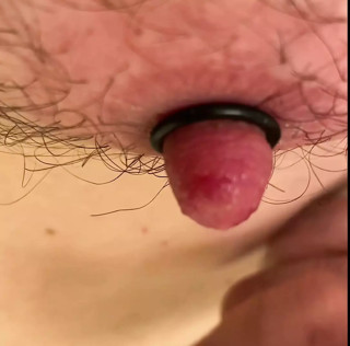 Nipple stretching procedure