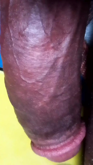 Dick