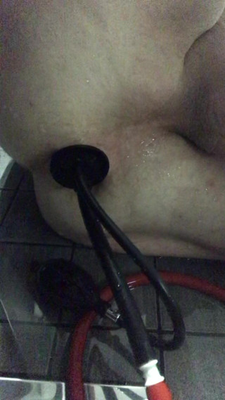 Enema 2