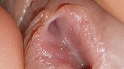Enlargement of the Deep Urethral Hole!!