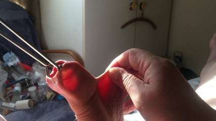 Three minutes of foreskin stretch in sunlight: tongs