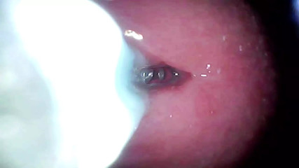 The camera in the penis shows the best picture of the male orgasm event