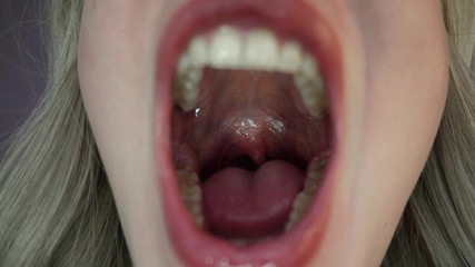 /beam/69635c603f0d81077a47f5ac