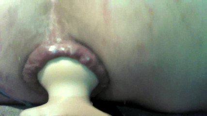 Swollen Prolaps ass Fuck 3