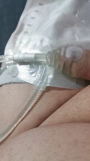 Peeing and cum in My catheter