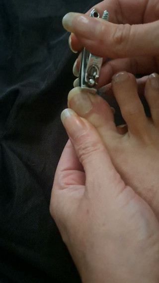 Long Toenail Clipping
