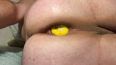 Limon insertion 
