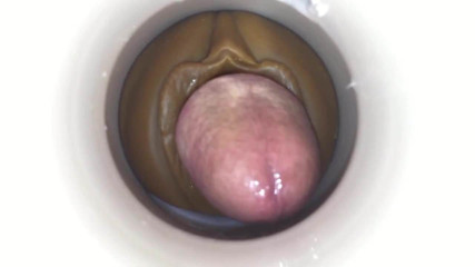 Cum extract