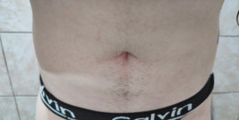 I Caress, Squeeze and Inflate My Hairy Belly