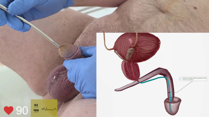 Second time trying urethral sounding and reviewing anatomy