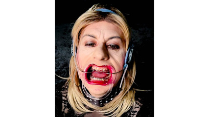 Extreme braces headgear and open mouth expander fetish thumbnail