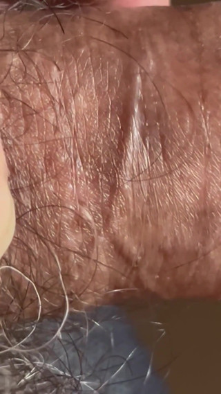Closeup of Penis with One Vein