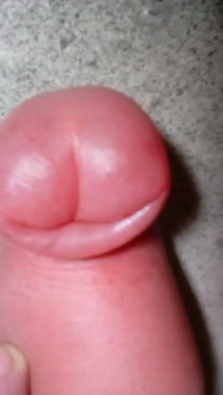 Jens11 hard pumped cock and foreskin 2
