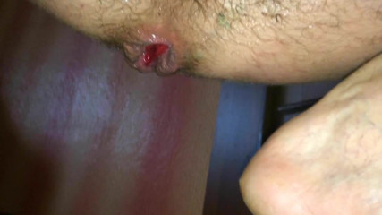 Anal plug