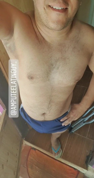 AMPUTEE guy showing his body