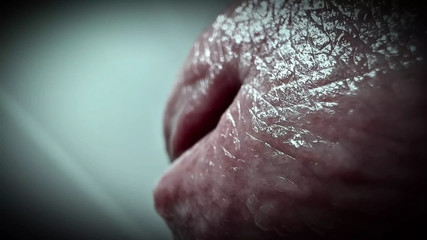 why is my pee hole always so damp?