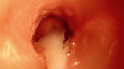 Huge Cumshot inside HOLE! BEST CUMSHOT INSIDE ANAL! ASMR
