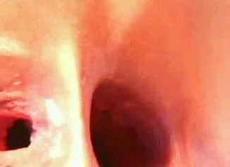 /beam/2691215