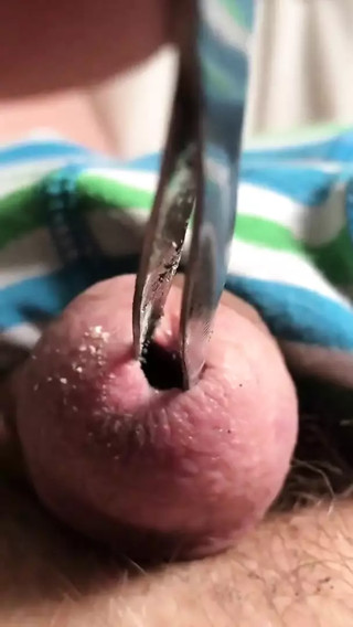Put that match out
