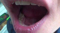 Kate open her mouth wide for you